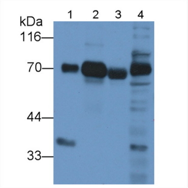 Dystrophin (DMD) Human Monoclonal Antibody