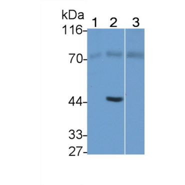 Dystrophin (DMD) Human Monoclonal Antibody