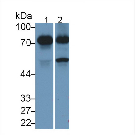 Dystrophin (DMD) Human Monoclonal Antibody