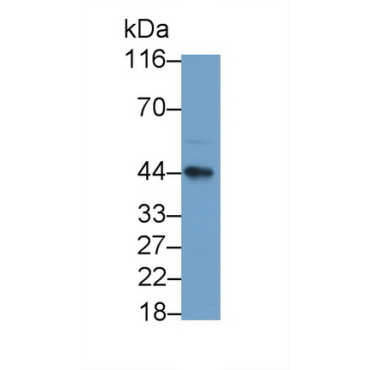 Killer Cell Immunoglobulin Like Receptor 2DL1 (KIR2DL1) Human Monoclonal Antibody