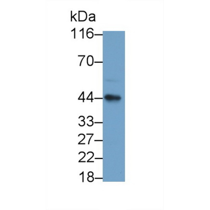 Killer Cell Immunoglobulin Like Receptor 2DL1 (KIR2DL1) Human Monoclonal Antibody