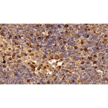 Killer Cell Immunoglobulin Like Receptor 2DL1 (KIR2DL1) Human Monoclonal Antibody