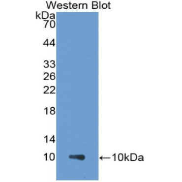 Pulmonary Activation Regulated Chemokine (PARC) Human Monoclonal Antibody