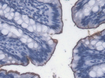 Lipopolysaccharide (LPS) Pan-species (General) Monoclonal Antibody