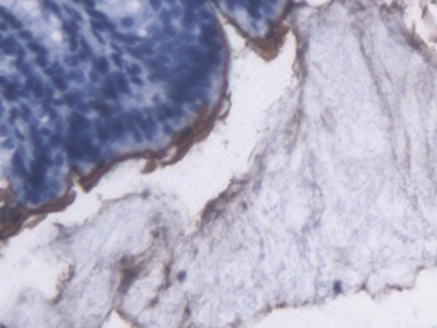 Lipopolysaccharide (LPS) Pan-species (General) Monoclonal Antibody