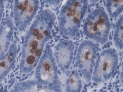 Lipopolysaccharide (LPS) Pan-species (General) Monoclonal Antibody