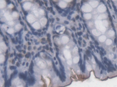 Lipopolysaccharide (LPS) Pan-species (General) Monoclonal Antibody