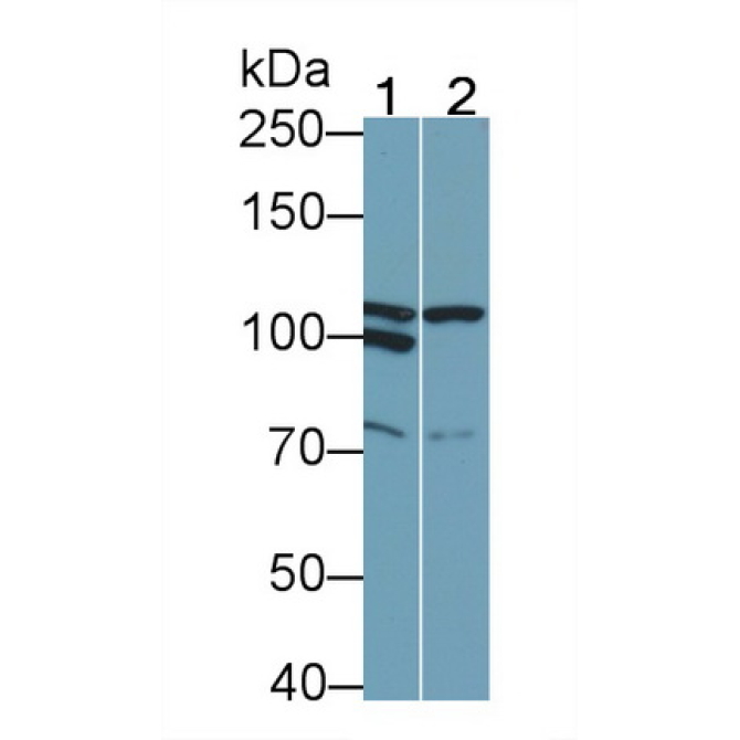 Colony Stimulating Factor 2 Receptor Beta (CSF2Rb) Mouse Monoclonal Antibody