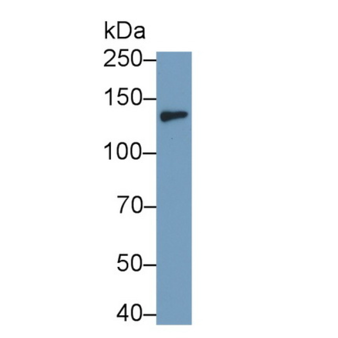 Colony Stimulating Factor 2 Receptor Beta (CSF2Rb) Mouse Monoclonal Antibody