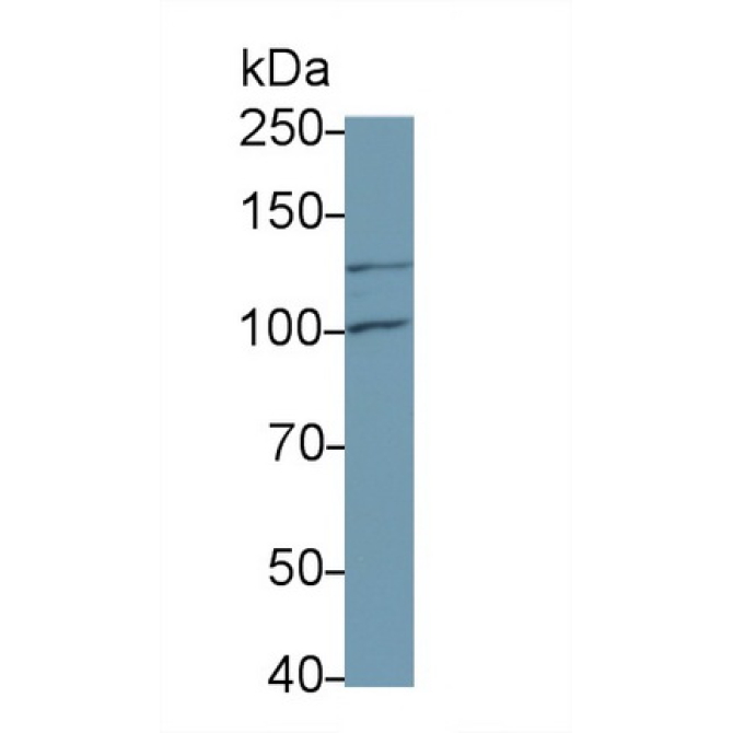 Colony Stimulating Factor 2 Receptor Beta (CSF2Rb) Mouse Monoclonal Antibody
