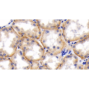 Cluster Of Differentiation 147 (CD147) Human Monoclonal Antibody
