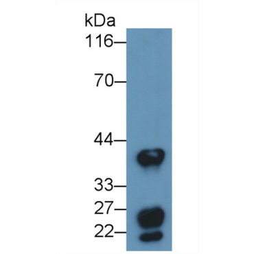 Cluster Of Differentiation 147 (CD147) Human Monoclonal Antibody