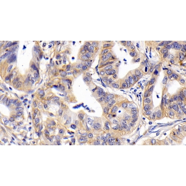 Cluster Of Differentiation 147 (CD147) Human Monoclonal Antibody
