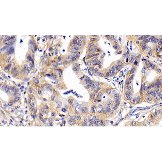 Cluster Of Differentiation 147 (CD147) Human Monoclonal Antibody