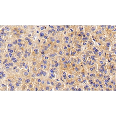 Cluster Of Differentiation 147 (CD147) Human Monoclonal Antibody