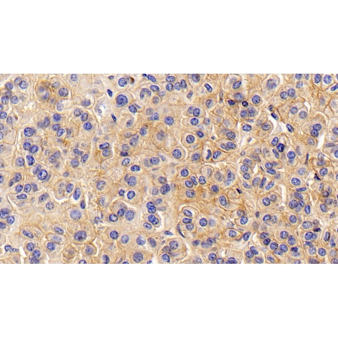 Cluster Of Differentiation 147 (CD147) Human Monoclonal Antibody