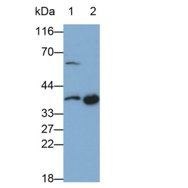 Signaling Lymphocytic Activation Molecule Family, Member 1 (SLAMF1) Human Monoclonal Antibody