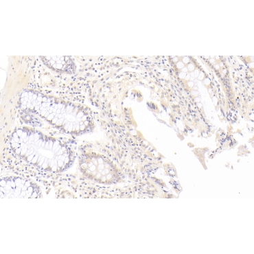 Indoleamine-2,3-Dioxygenase (IDO) Human Monoclonal Antibody