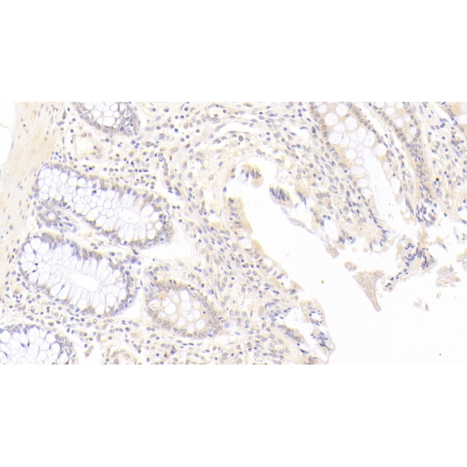Indoleamine-2,3-Dioxygenase (IDO) Human Monoclonal Antibody
