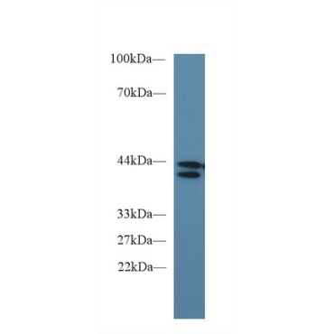 Indoleamine-2,3-Dioxygenase (IDO) Human Monoclonal Antibody
