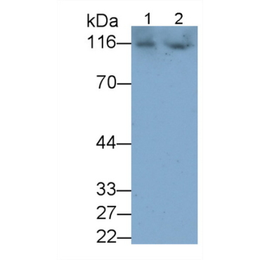 A Disintegrin And Metalloprotease 17 (ADAM17) Human Monoclonal Antibody