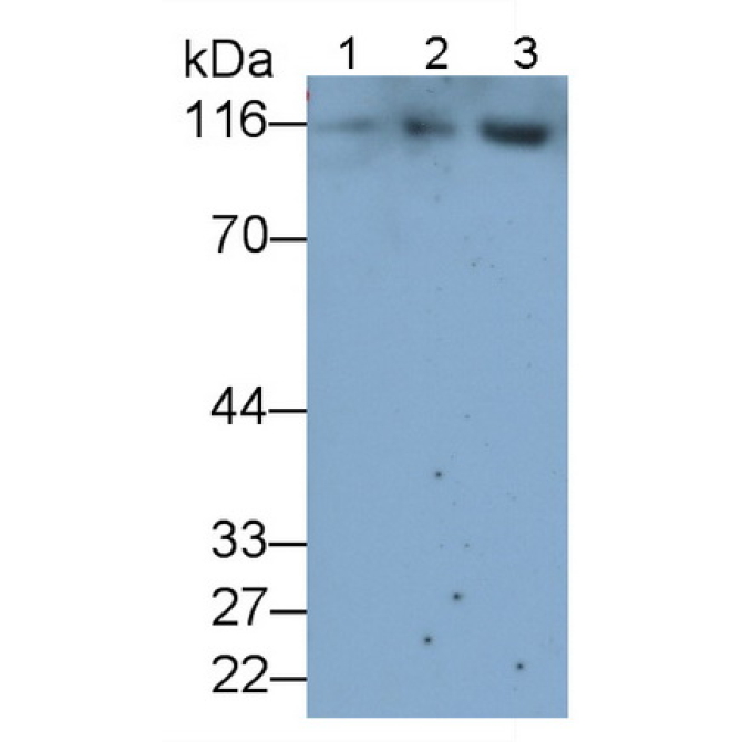 A Disintegrin And Metalloprotease 17 (ADAM17) Human Monoclonal Antibody