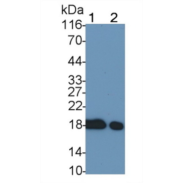 Cofilin 1 (CFL1) Human Monoclonal Antibody