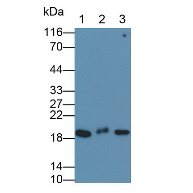 Cofilin 1 (CFL1) Human Monoclonal Antibody