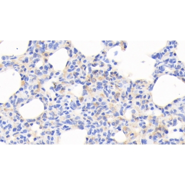 Cofilin 1 (CFL1) Human Monoclonal Antibody