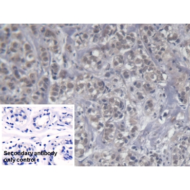 Killer Cell Immunoglobulin Like Receptor 2DS4 (KIR2DS4) Human Monoclonal Antibody