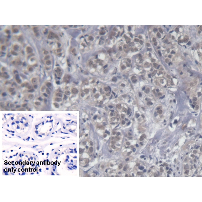 Killer Cell Immunoglobulin Like Receptor 2DS4 (KIR2DS4) Human Monoclonal Antibody