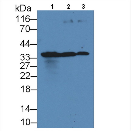 Killer Cell Immunoglobulin Like Receptor 2DS4 (KIR2DS4) Human Monoclonal Antibody