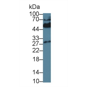 Killer Cell Immunoglobulin Like Receptor 2DS4 (KIR2DS4) Human Monoclonal Antibody