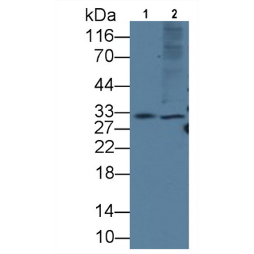 Killer Cell Immunoglobulin Like Receptor 2DS4 (KIR2DS4) Human Monoclonal Antibody