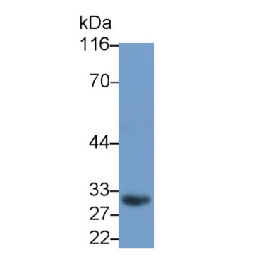 Cluster Of Differentiation 23 (CD23) Human Monoclonal Antibody