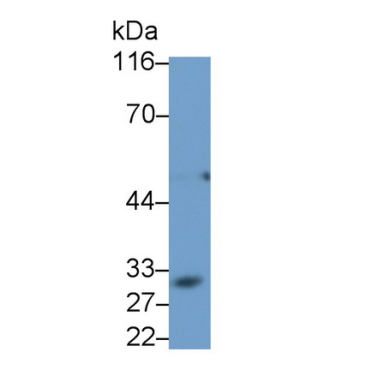Cluster Of Differentiation 23 (CD23) Human Monoclonal Antibody