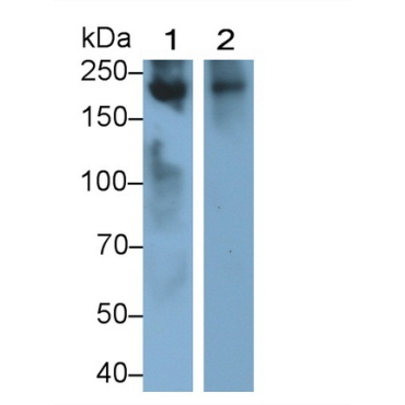 Lymphocyte Antigen 75 (LY75) Human Monoclonal Antibody