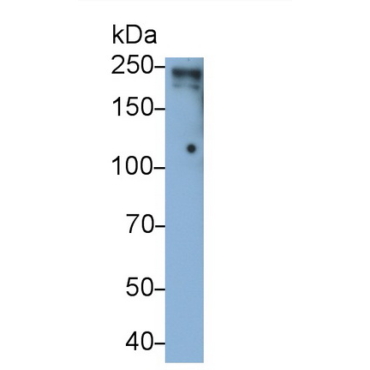 Lymphocyte Antigen 75 (LY75) Human Monoclonal Antibody