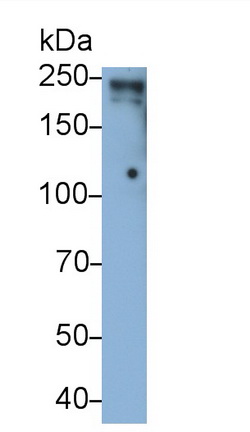 Lymphocyte Antigen 75 (LY75) Human Monoclonal Antibody