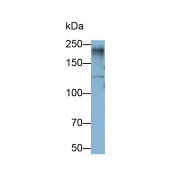 Lymphocyte Antigen 75 (LY75) Human Monoclonal Antibody