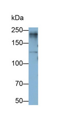 Lymphocyte Antigen 75 (LY75) Human Monoclonal Antibody