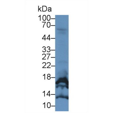 Chorionic Gonadotropin Alpha Polypeptide (CGa) Human Monoclonal Antibody