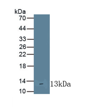 Interleukin 10 Receptor Alpha (IL10Ra) Human Monoclonal Antibody