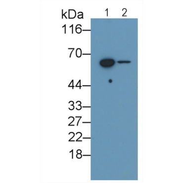 Interleukin 10 Receptor Beta (IL10Rb) Human Monoclonal Antibody