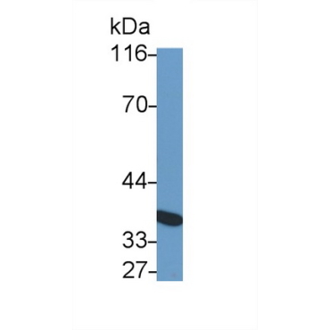 Interleukin 10 Receptor Beta (IL10Rb) Human Monoclonal Antibody