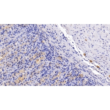 Chemokine C-C-Motif Receptor 7 (CCR7) Human Monoclonal Antibody