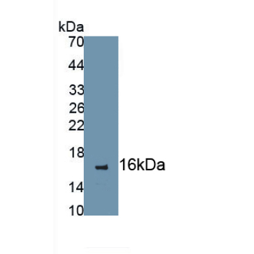 Chemokine C-C-Motif Receptor 7 (CCR7) Human Monoclonal Antibody