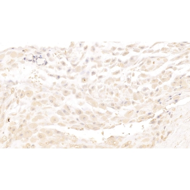 Major Basic Protein (MBP) Human Monoclonal Antibody