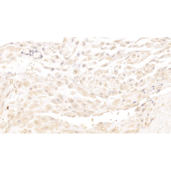 Major Basic Protein (MBP) Human Monoclonal Antibody