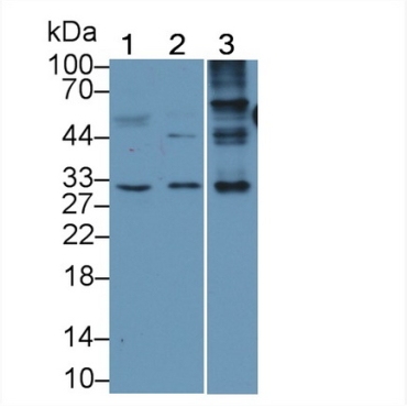 Major Basic Protein (MBP) Human Monoclonal Antibody